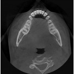     Rayscan α+ 3D 130x100 Ceph